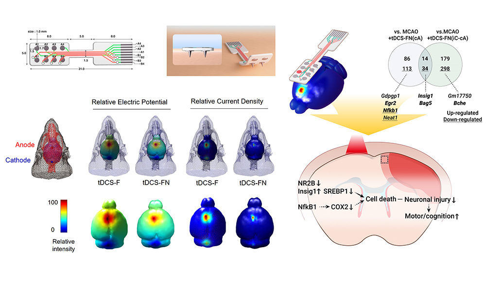 'Therapeutic effects of a novel electrode for transcranial direct current stimulation in ischemic stroke mice'