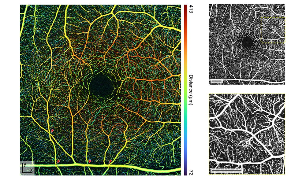 'Phase-Locked Time-Stretch Optical Coherence Tomography for Contrast-Enhanced Retinal Microangiography'
